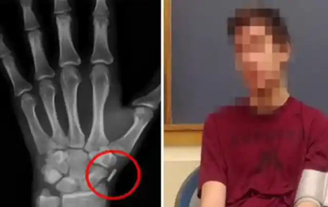 An Implant
